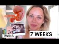 7 WEEKS PREGNANT WITH TWINS | 7 WEEK PREGNANCY UPDATE | Lucy Jessica Carter