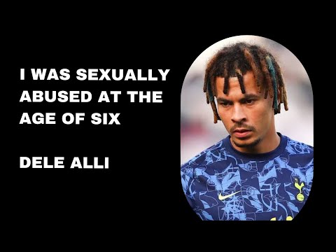 Dele Alli Shocking