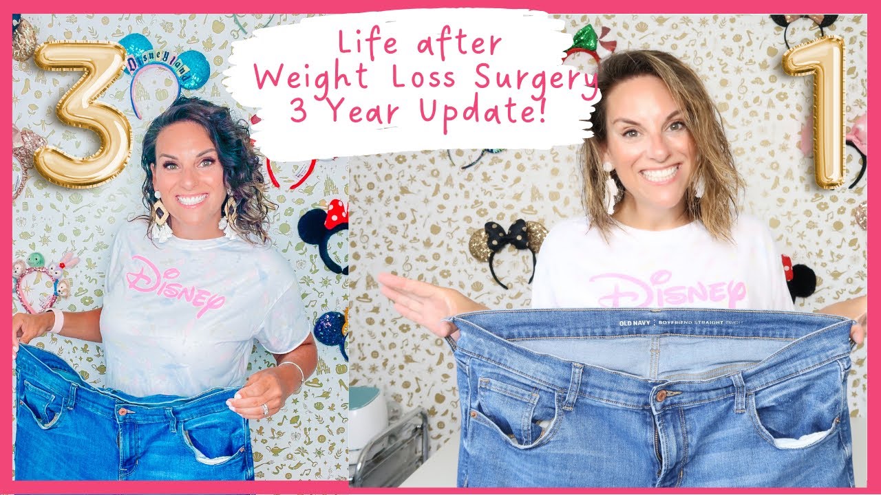 Weight Loss Surgery Questions & Answers My Weight Loss Surgery Journey