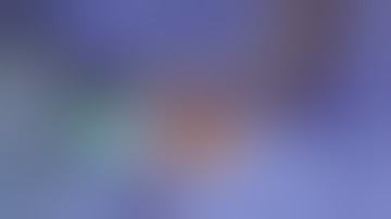 Xi Thoracic Port Placement