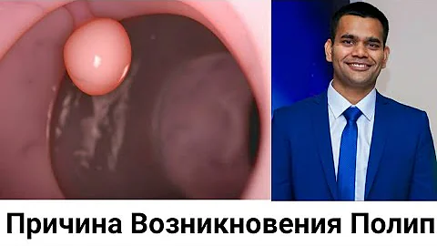 Полипы - Причина Возникновения Полип И Их Лечения