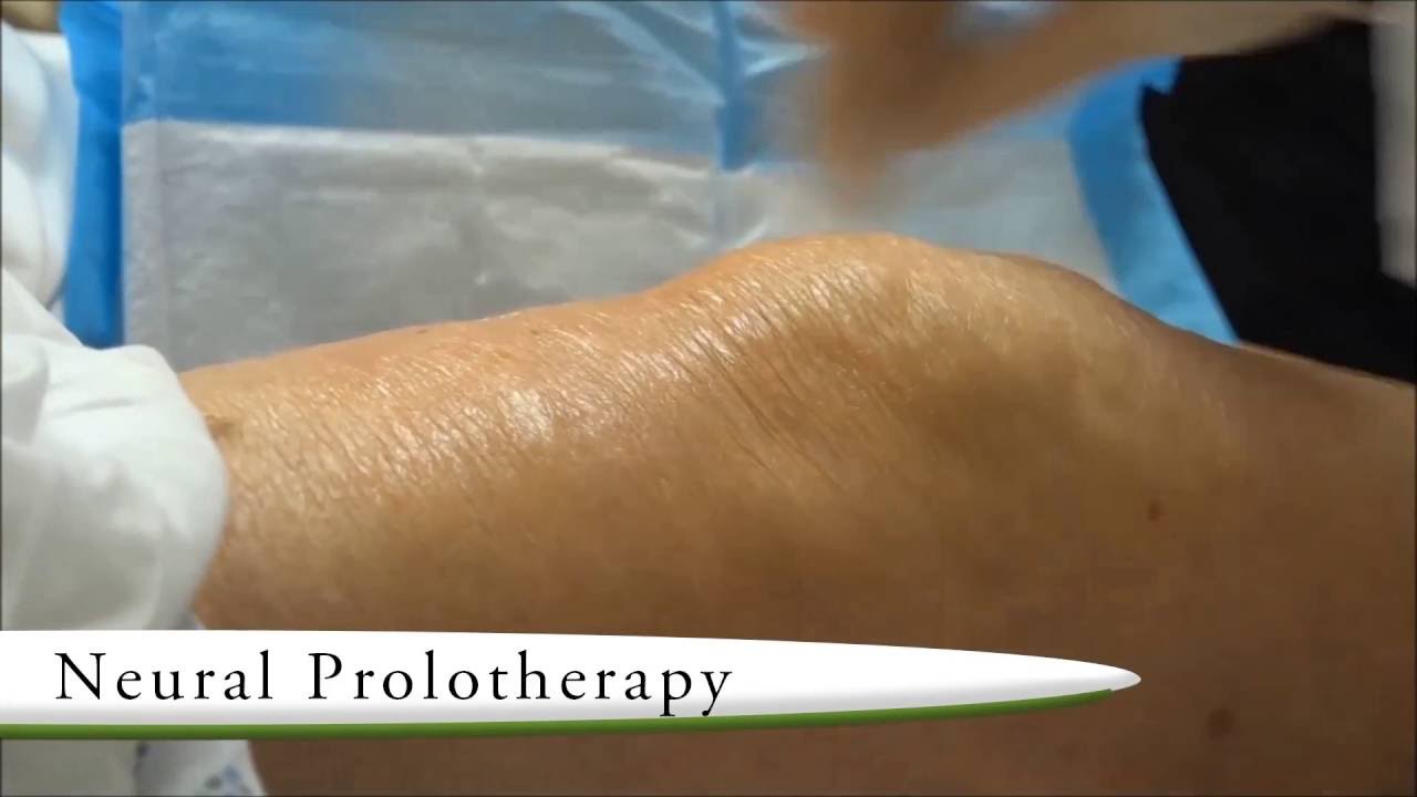 Neural Prolotherapy YouTube
