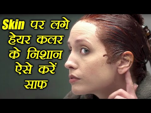 वीडियो: झड़ने के बाद बाल कैसे उगाएं (महिलाएं)