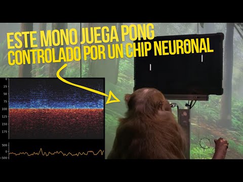 Estamos a muy poco de tener chips neuronales ¿Cómo van a ser? /Roja, En Vivo.