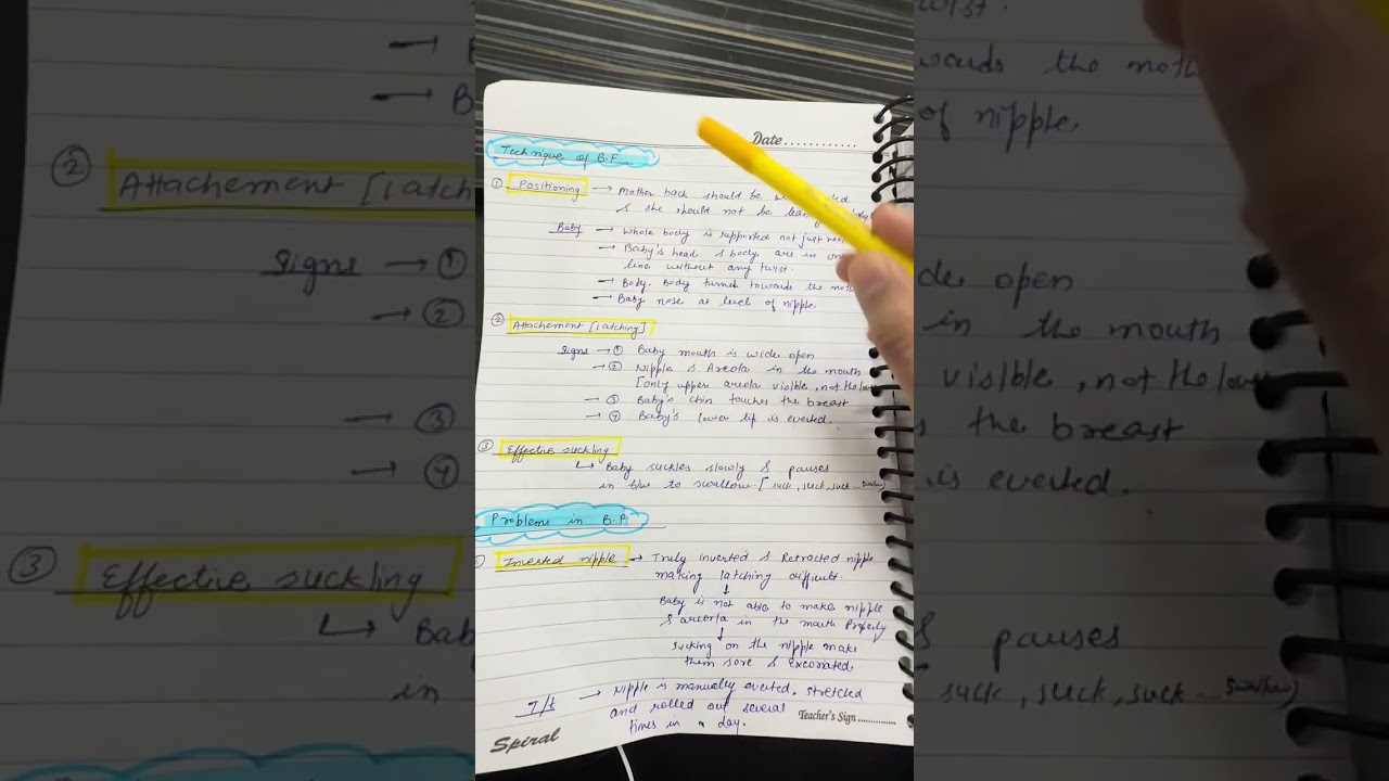 Breast feeding paediatrics short notes for rapid revision of theory exam 