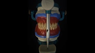 Total Protezlerde Diş Eti Modelajı Wax Contouring of Complete Denture