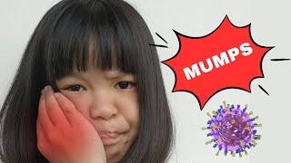 Mumps - Causes, Signs &amp; Symptoms, Diagnosis, And Treatment