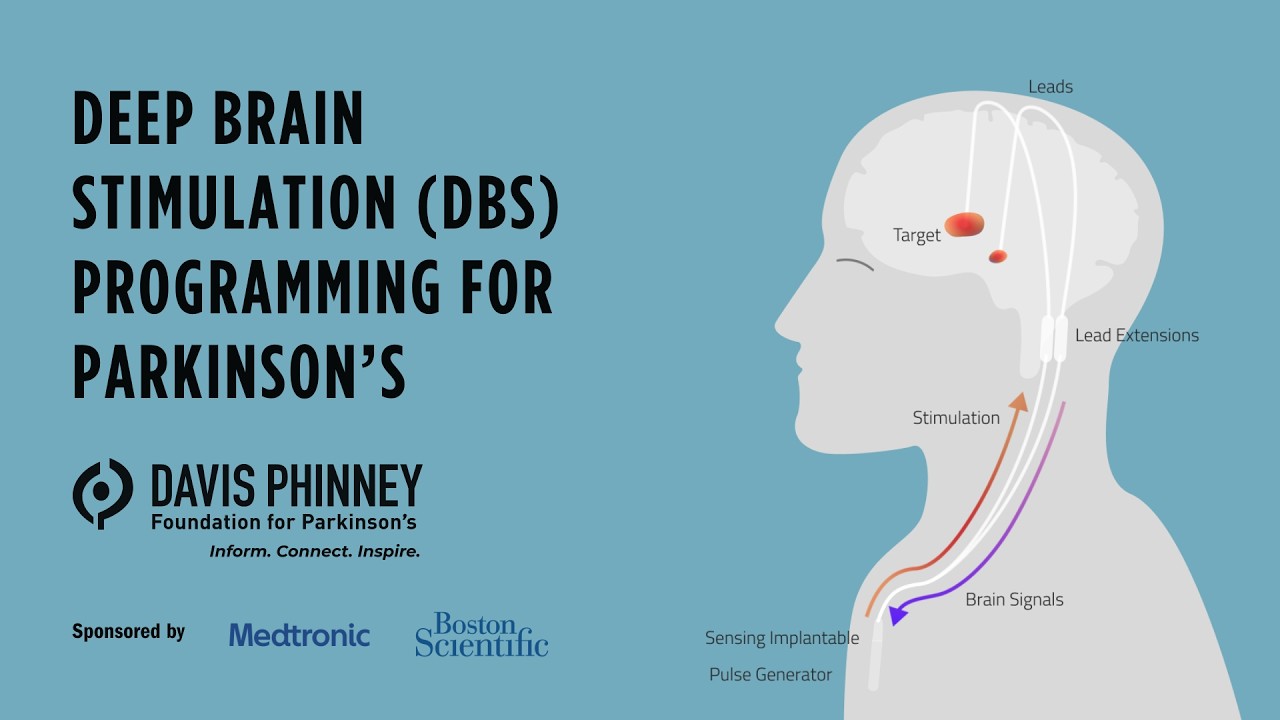 Parkinson's DBS Programming: Evaluation, Optimization, and Why Your Programmer Matters