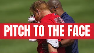 Justin Turner taken to hospital after being Hit in the face