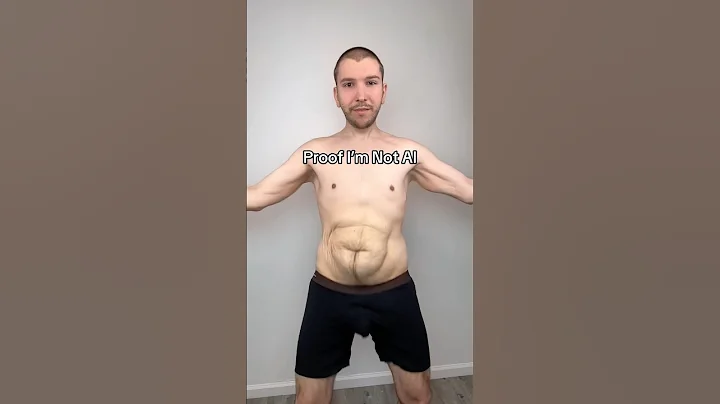 How Much Loose Skin Do I Have?