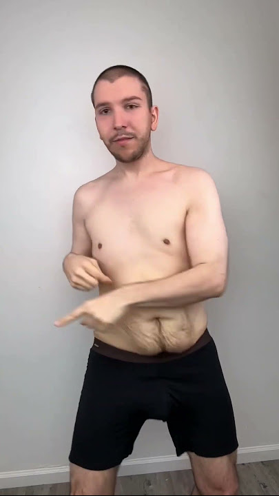 How Much Loose Skin Do I Have?