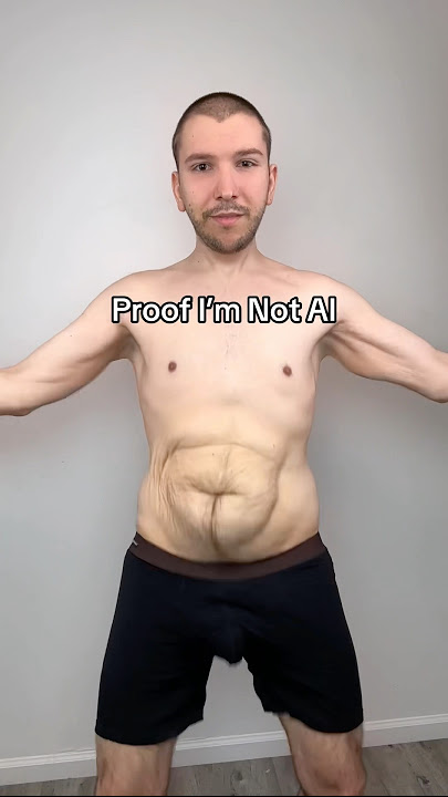 How Much Loose Skin Do I Have?