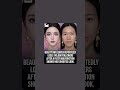 Beauty Filter FAIL: Influencer Loses 140KFollowers After Unedited Reveal