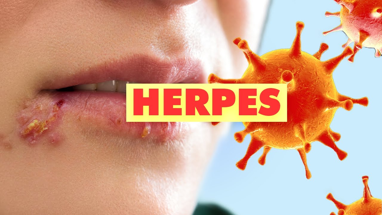 [ Q&A ] HERPES, NAMAMAGANG ITLOG, ERECTILE DYSFUNCTION, SPIRULINA YouTube