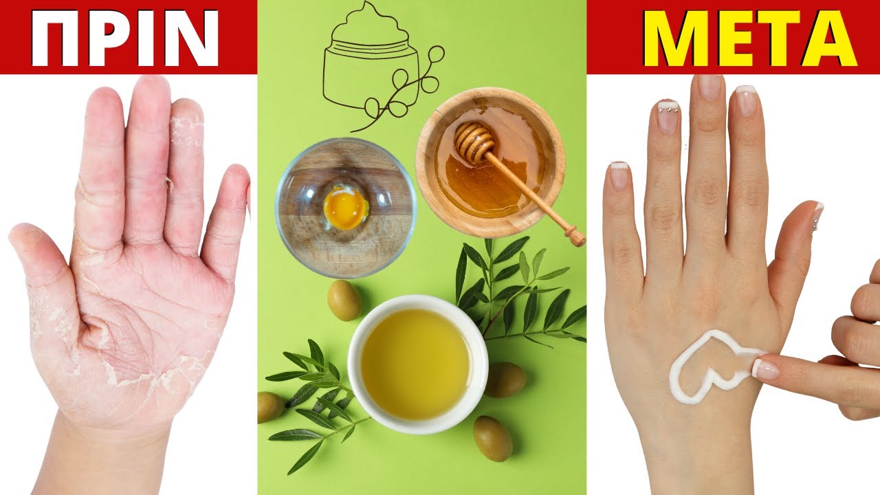 Η #1 Φυσική Συνταγή Για Ξηρότητα & Ρυτίδες Σε Χέρια Και Σώμα