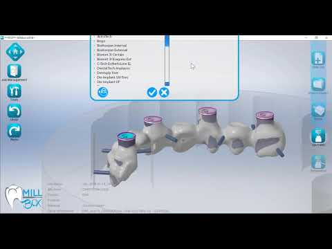 MillBox - Replace Mulitple Abutments