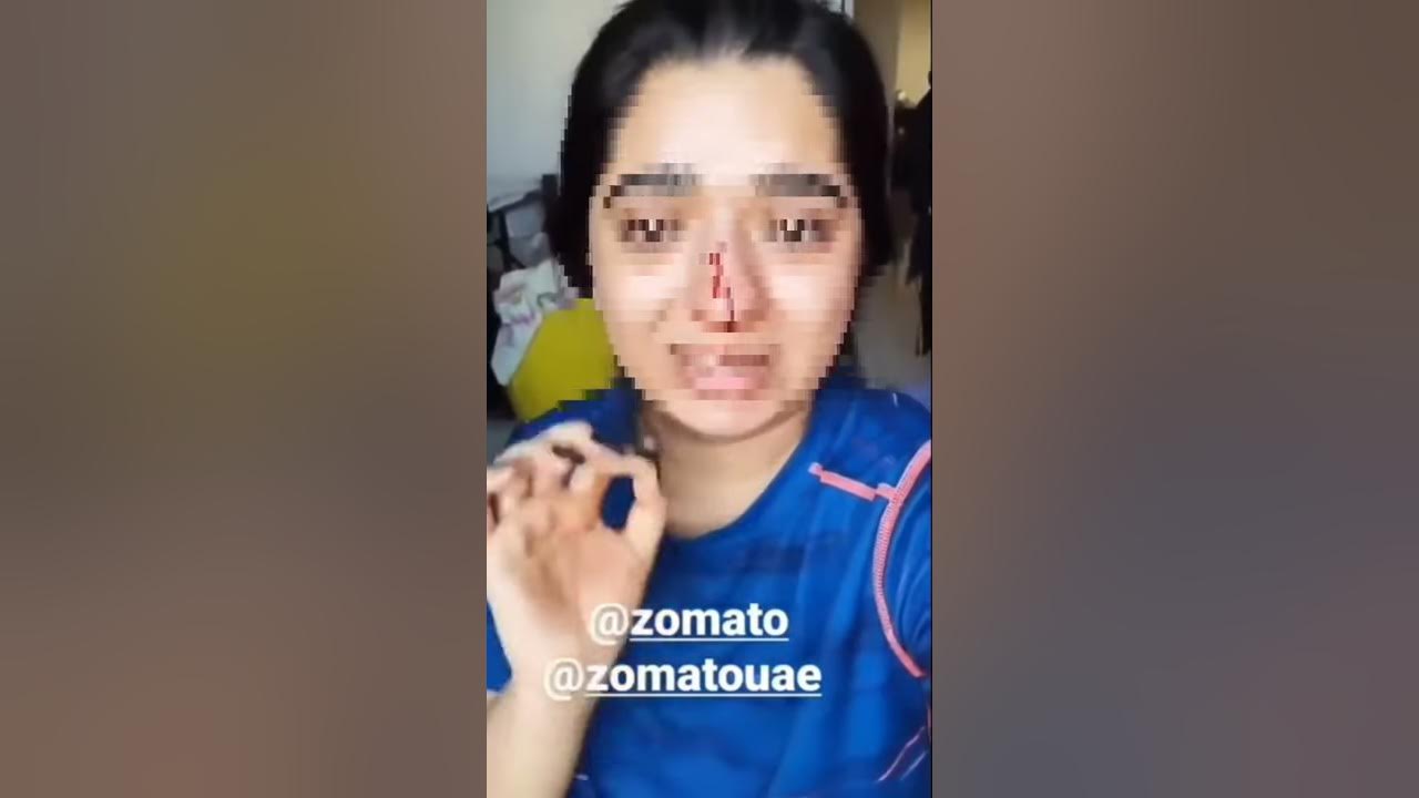 zomato-delivery-boy-hits-a-girl-on-nose-and-run-away-after-she