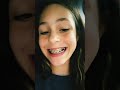 Transition pink/blue to blue/coral Braces #braces