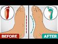 How to build foot  toe strength
