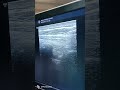 cancer pain/chest pain/post operative pain/
