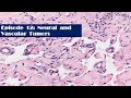 Episode 12 neural and vascular tumors