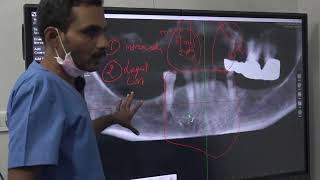 Cortico Basal Dental Implant Course November 2023-Dr C.Murugavel -part-14