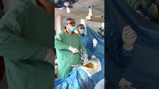 Live-Operative Endoscopic Spine Surgery Bootcamp 2026 by Dr Achal Gupta | Learning Beyond Textbooks