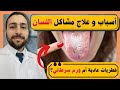 أسباب تغير لون اللسان وعلاجها و متى تكون خطيرة و تستدعي تدخل طبي