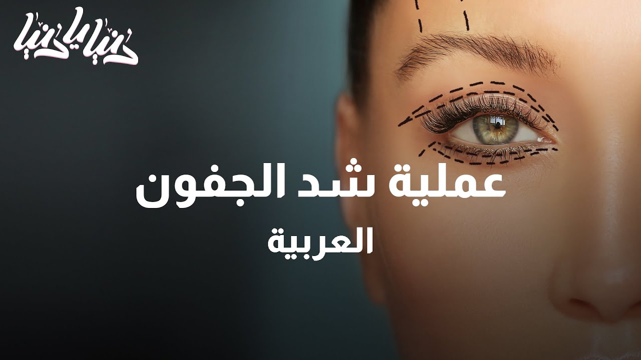 عمليات شد الجفون وتجميل العين - دنيا يا دنيا #صحة
