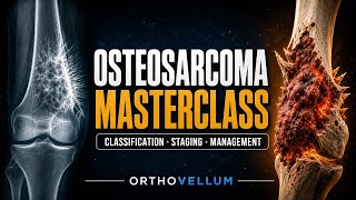 Osteosarcoma Masterclass: Staging, MAP Chemotherapy, Surgery & Prognosis