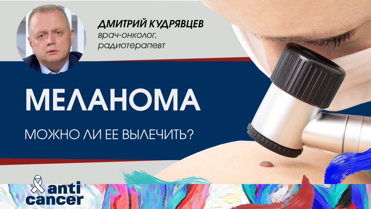 Меланома – черная королева онкологии. Можно ли ее вылечить и как выявить опасные изменения на коже?