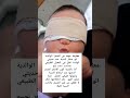 معلومة مهمه عن الصفرا الوالدية ابو صفار النسبة عند حديثي الولادة تظل في المعدل الطبيعي مادامت تحت 15