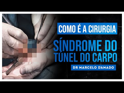 Vídeo: O que é a síndrome do cirurgião?