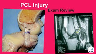 PCL Injury Exam Review - Raymond Kim, MD Profile