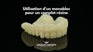 Utilisation d&#39;un monobloc pour la réalisation d&#39;un complet résine