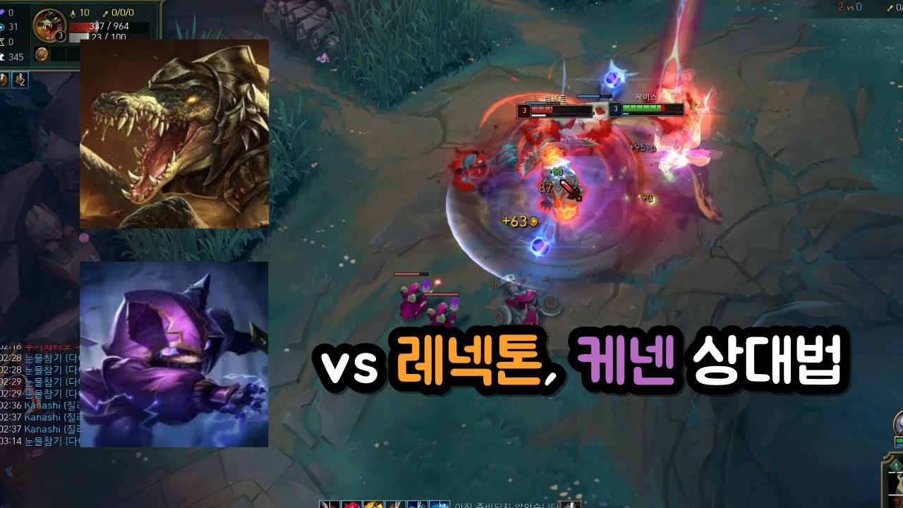 제이스로 얘네한테 지면 바보