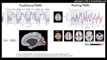 Resting-state functional magnetic resonance imaging (rsfMRI)