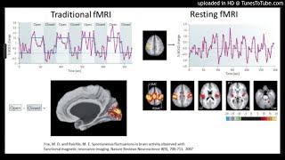 Resting-state functional magnetic resonance imaging (rsfMRI)