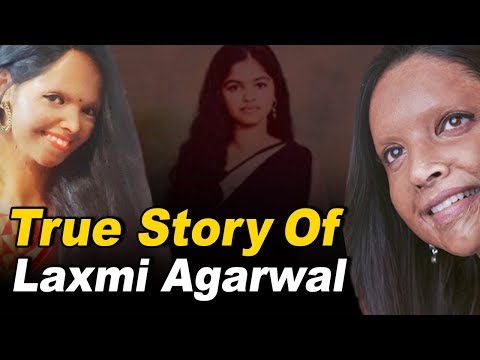 laxmi-agarwal-की-सच्ची-कहानी-जिसपर-बनी-है-deepika-की-फिल्म-chhapaak