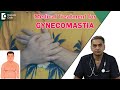 Gynecomastia medical treatment  3 types of male breast reduction  dr srikanth v  doctors circle