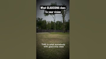 This is what glaucoma does to your vision