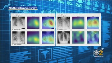 Northwestern Researchers Report Breakthrough Chest X-Ray Using AI To Detect COVID-19