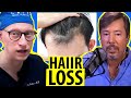 Hair Loss and Restoration with Spencer Kobren, Host of The Bald Truth