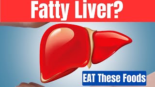 Fatty Liver NO MORE: Top 10 Powerful Superfoods for Natural Healing by Natures Lyfe 1,120 views 1 month ago 11 minutes, 56 seconds
