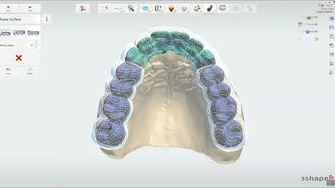 Welcome to 3Shape Splint Studio