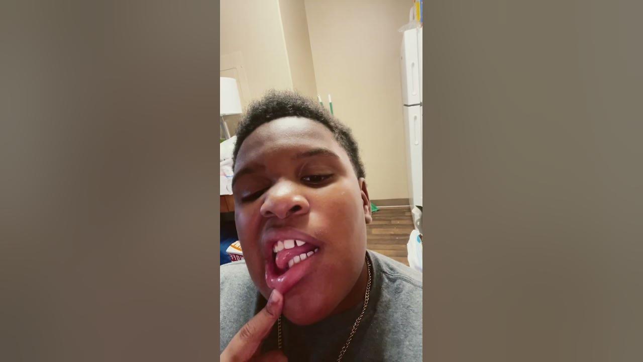 My tooth fell out - YouTube
