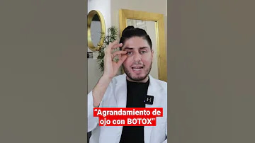 ¿Dónde se inyecta el bótox para agrandar los ojos?