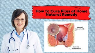 How to Cure Piles at Home - Natural Remedy