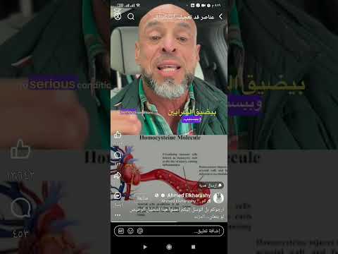 عندك تفكيرزائد ارهاق التهاب آلام أعمل تحليل هوموسيستين
