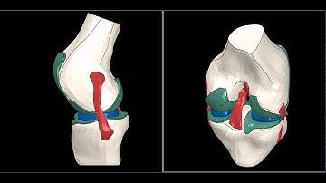 FEM KNEE JOINT ABAQUS